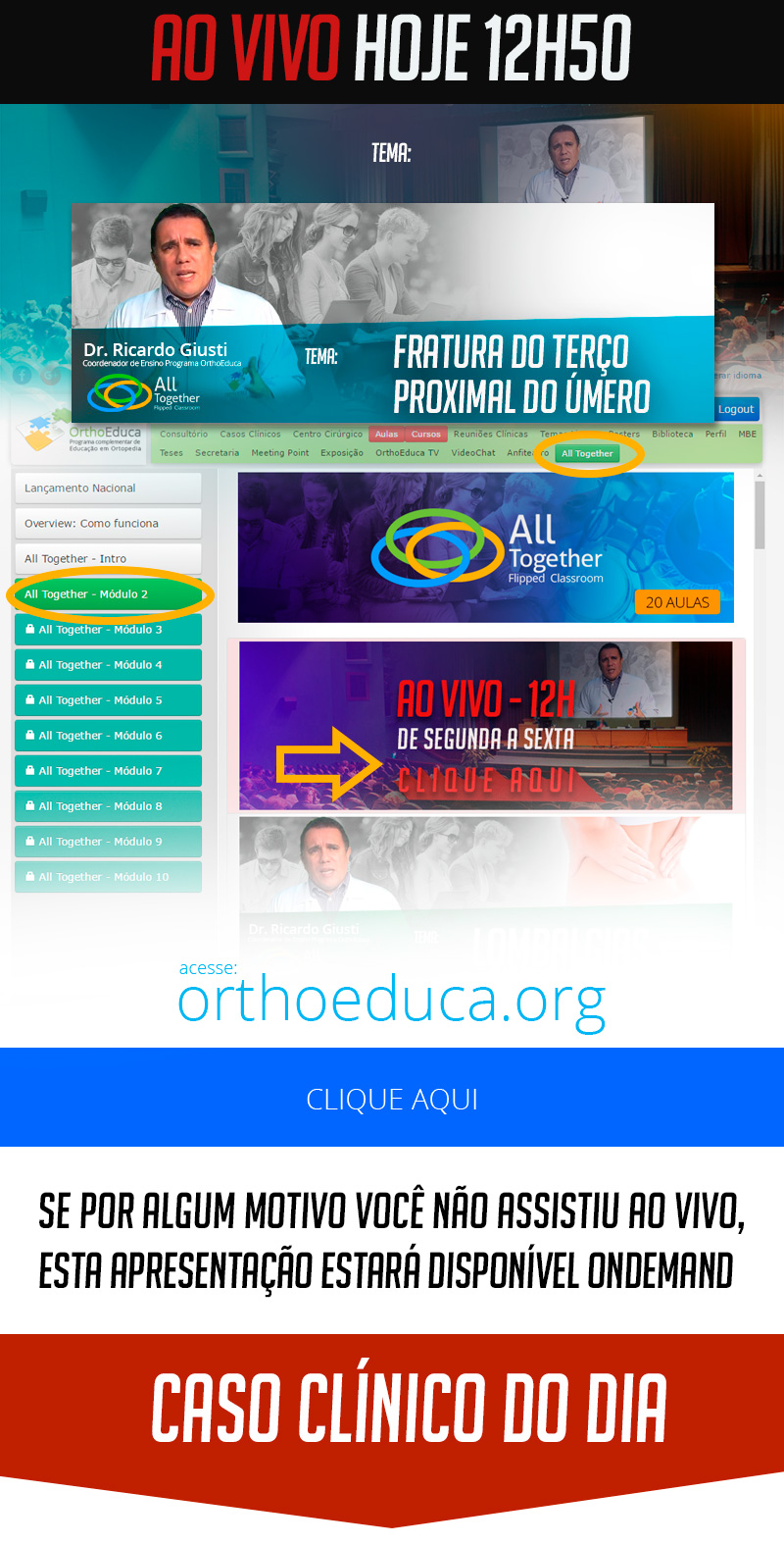 Fratura do terço proximal do úmero - Caso clínico de hoje no All Together às 12h50 Fratura do terço proximal do úmero - Caso clínico de hoje no All Together às 12h50