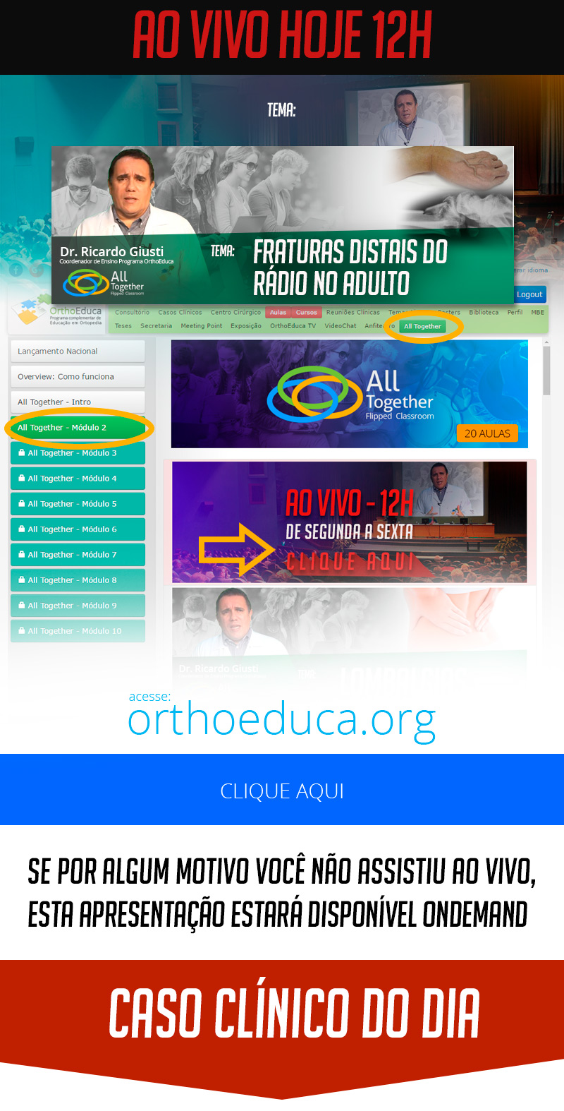 Fraturas Distais do Rádio no Adulto - Caso clínico de hoje no All Together às 12h Participe! Fraturas Distais do Rádio no Adulto - Caso clínico de hoje no All Together às 12h Participe!