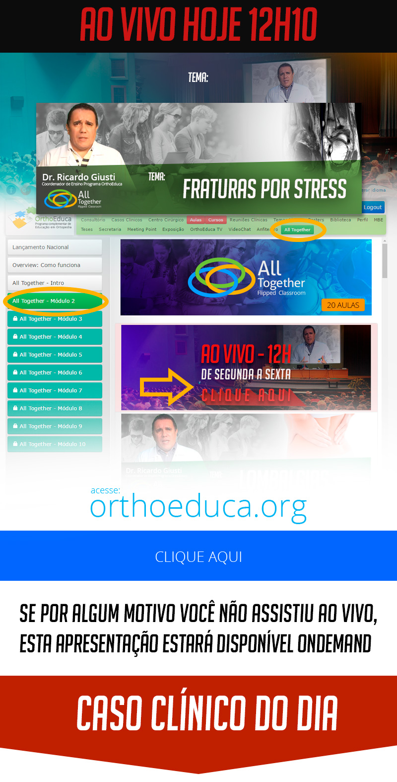 Fraturas por Stress - Caso clínico de hoje no All Together às 12h10 Participe! Fraturas por Stress - Caso clínico de hoje no All Together às 12h10 Participe!