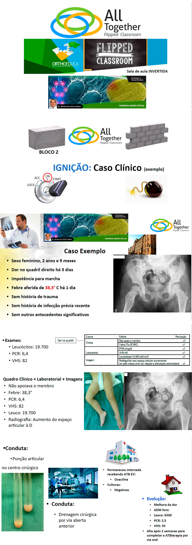 Pioartrites (Artrite Séptica) - Caso clínico de hoje no All Together às 12h Participe! Pioartrites (Artrite Séptica) - Caso clínico de hoje no All Together às 12h Participe!