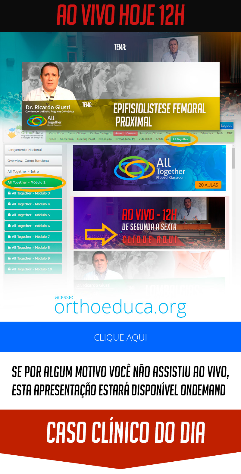 Epifisiolistese Femoral Proximal - Caso clnico de hoje no All Together s 12h Participe!