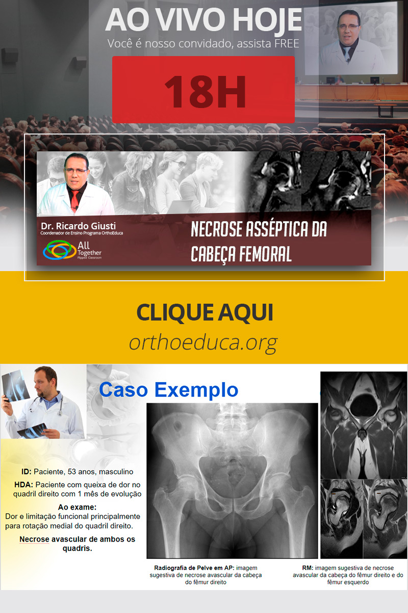 Necrose Assptica da Cabea Femoral - Daqui a pouco 18h AO VIVO! Participe!