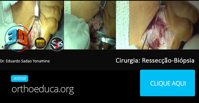 3D Full HD: Vídeos de cirurgia no OrthoEduca