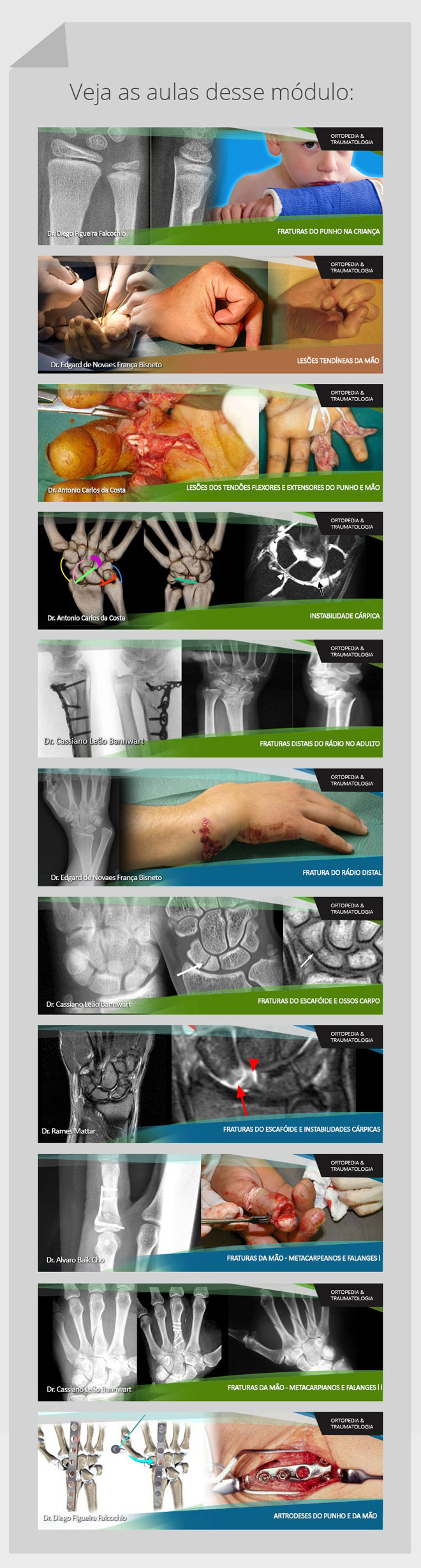 Punho e Mão: Cursos Online OrthoEduca