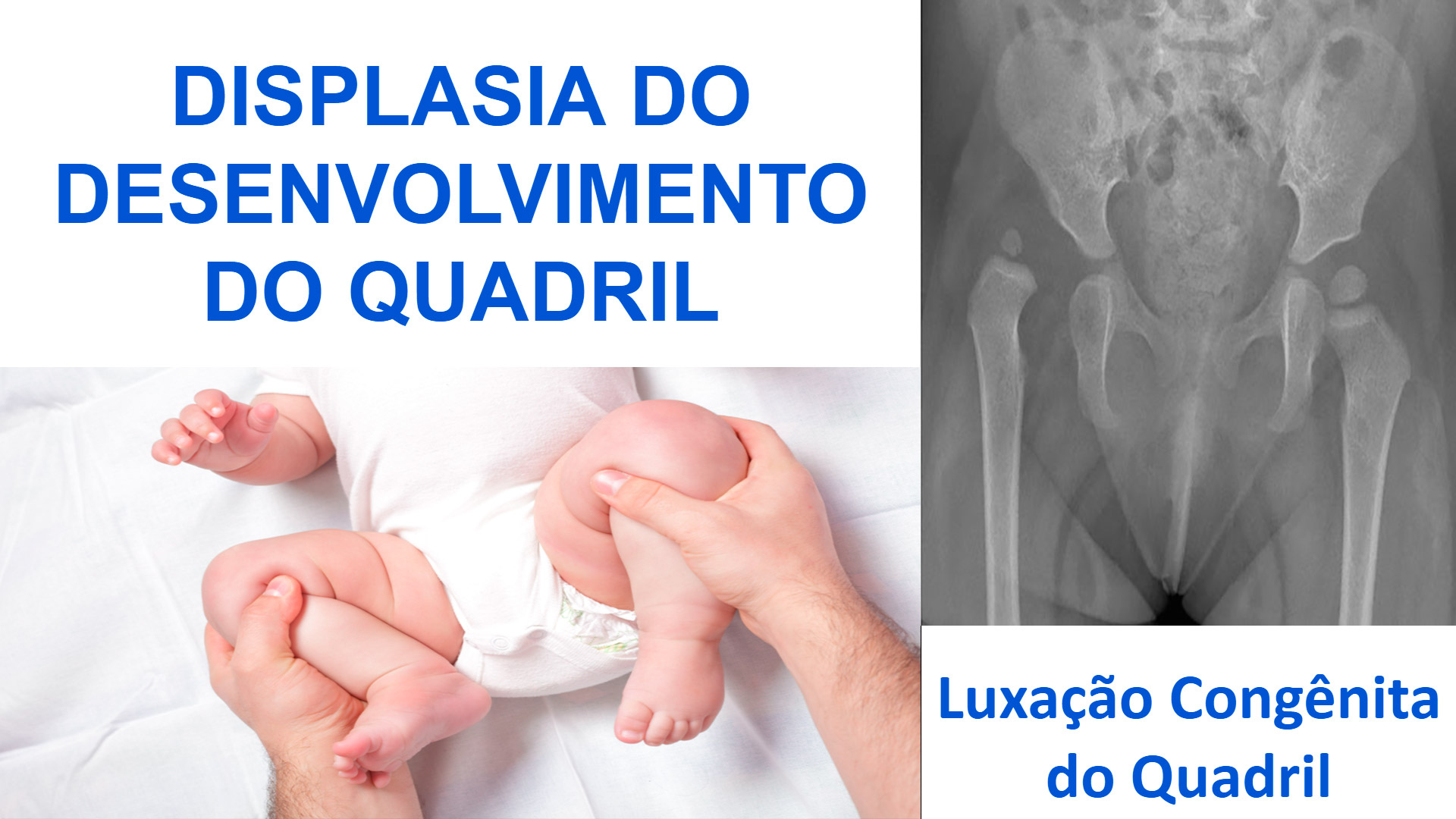 TEOT WARM UP  & SIMULADO 2023