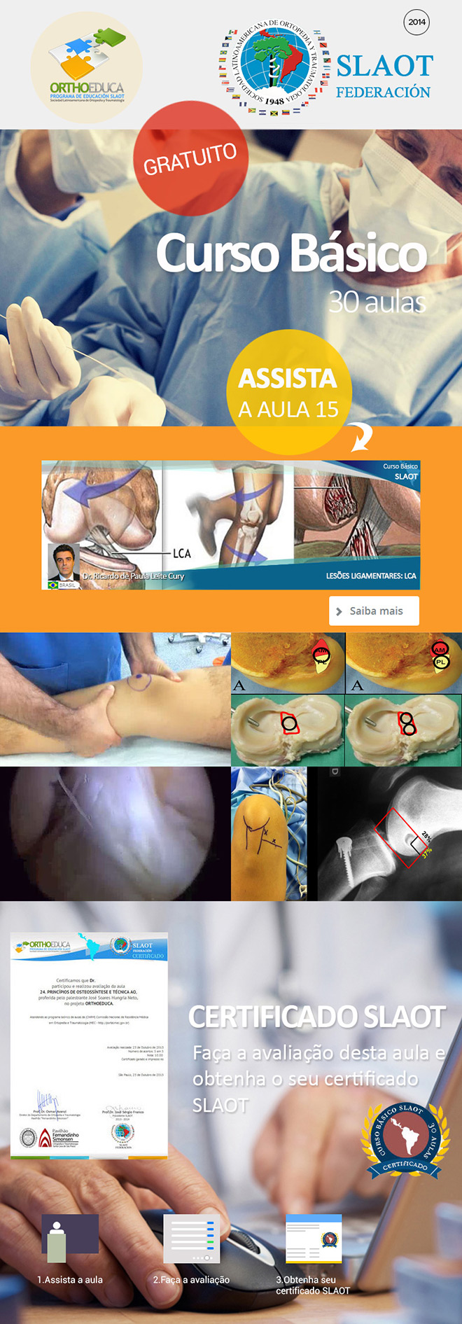 Assista a aula 15: Leses Ligamentares: LCA