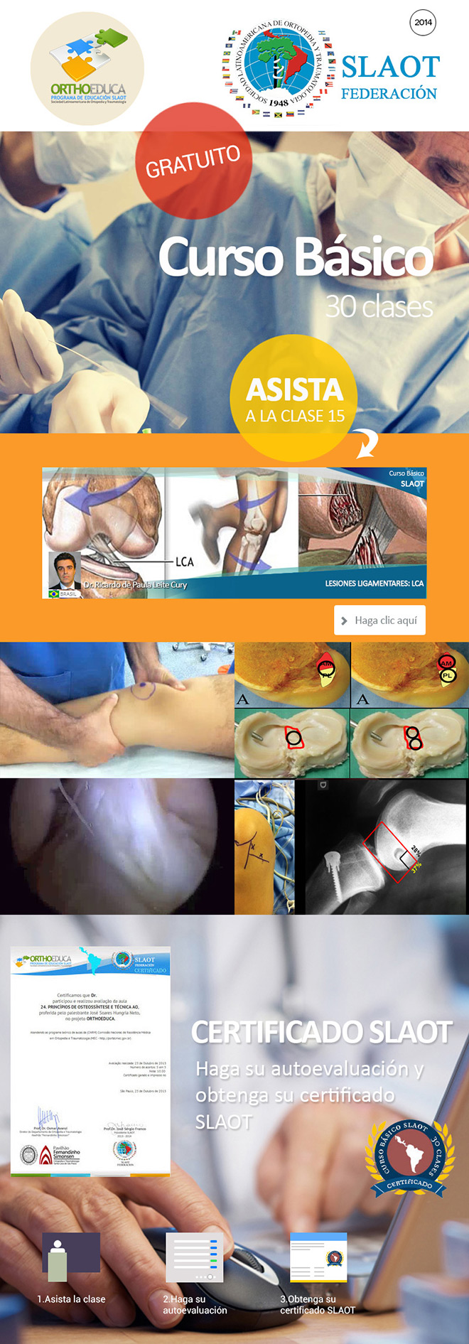 Asista a La Clase 15: Lesiones Ligamentares: LCA