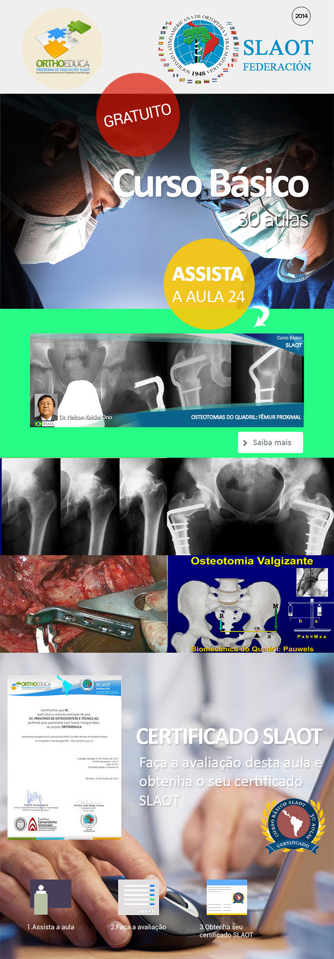 Assista a aula 24: Osteotomias do Quadril: Fêmur Proximal