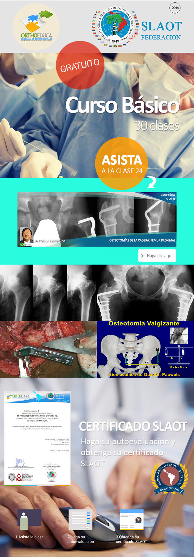 Asista a La Clase 24: Osteotomías de la Cadera: Femur Proximal
