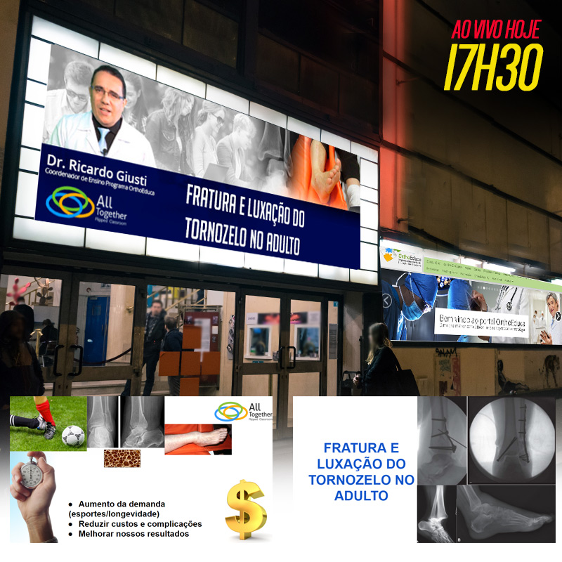 Fratura e Luxao do Tornozelo no Adulto - AO VIVO 17h30min - Participe!