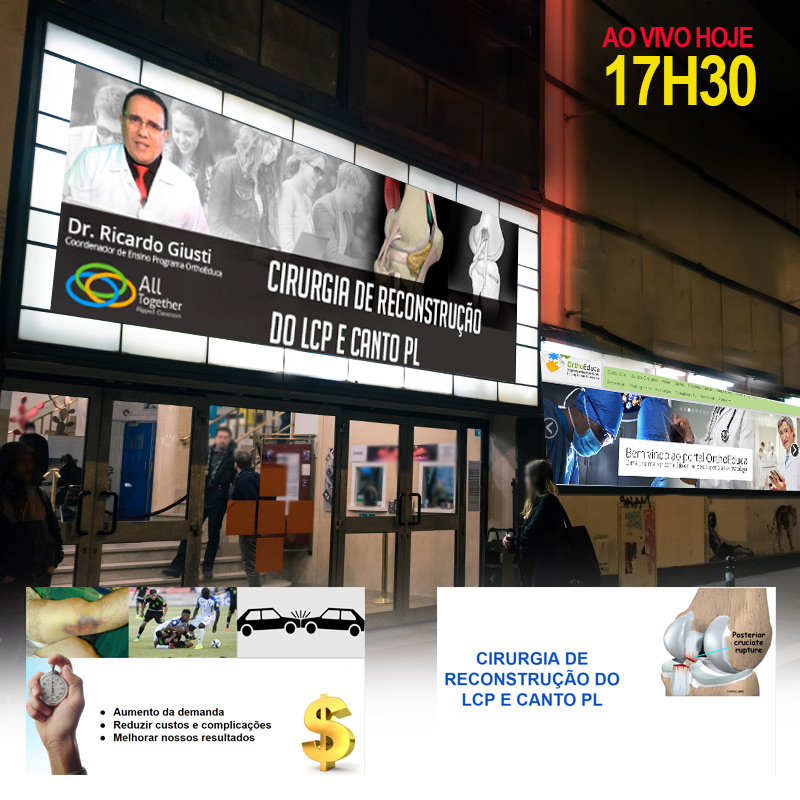 Cirurgia de Reconstruo do LCP E Canto PL - AO VIVO 17h30min - Participe!