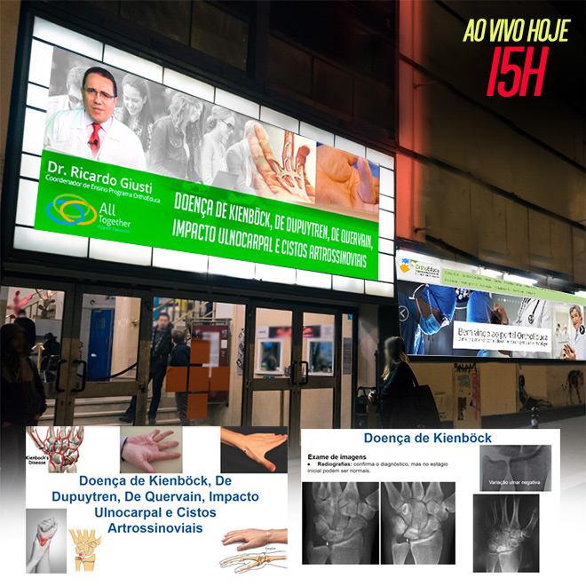Doena de Kienbck, De Dupuytren, De Quervain, Impacto Ulnocarpal e Cistos Artrossinoviais - AO VIVO 15h - Participe!