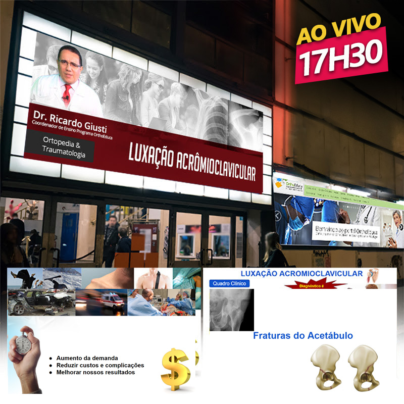 Luxação Acrômioclavicular - AO VIVO 17h30min - Participe!