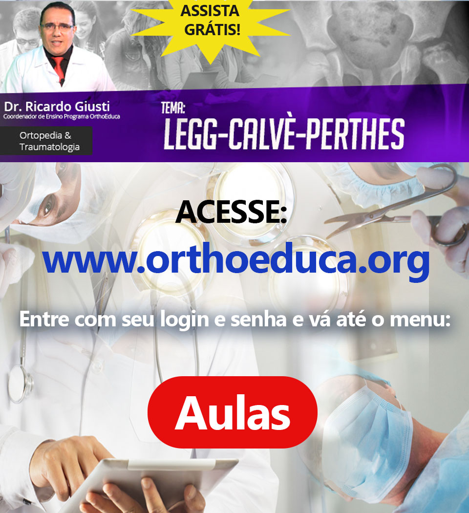 Legg-Calv-Perthes: OrthoEduca convida: Vamos estudar juntos?