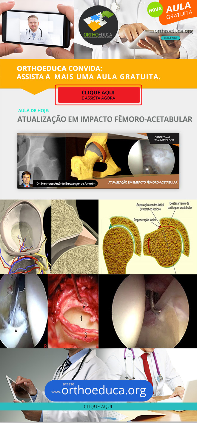 OrthoEduca Convida - Assista Hoje GRÁTIS: Atualização em Impacto Fêmoro-Acetabular