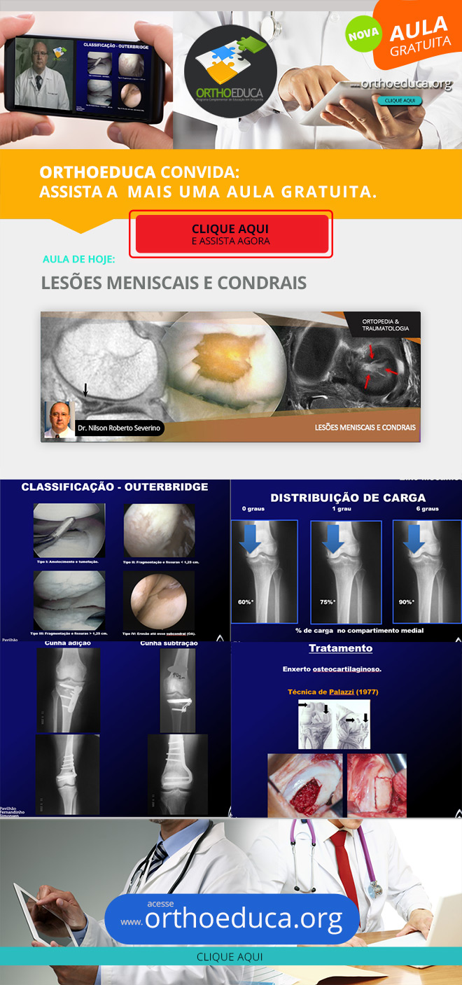 OrthoEduca Convida - Assista Hoje GRTIS: Leses Meniscais e Condrais