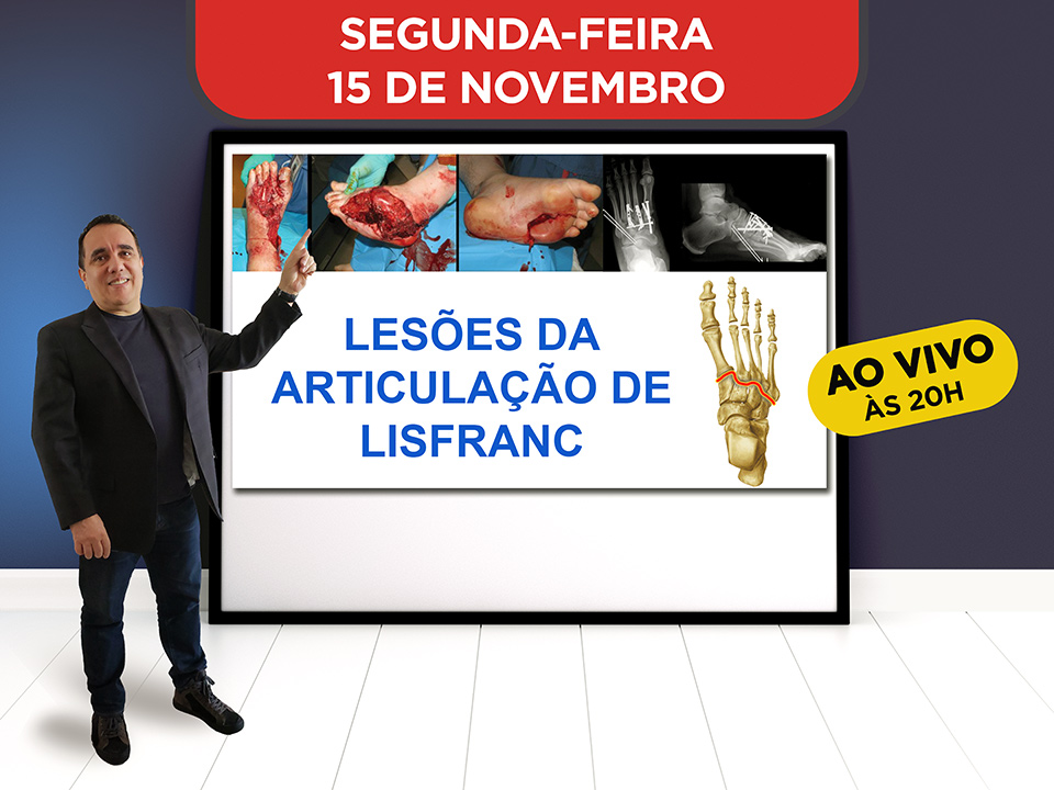 Leses da Articulao de Lisfranc - Hoje ao vivo s 20h, Participe!