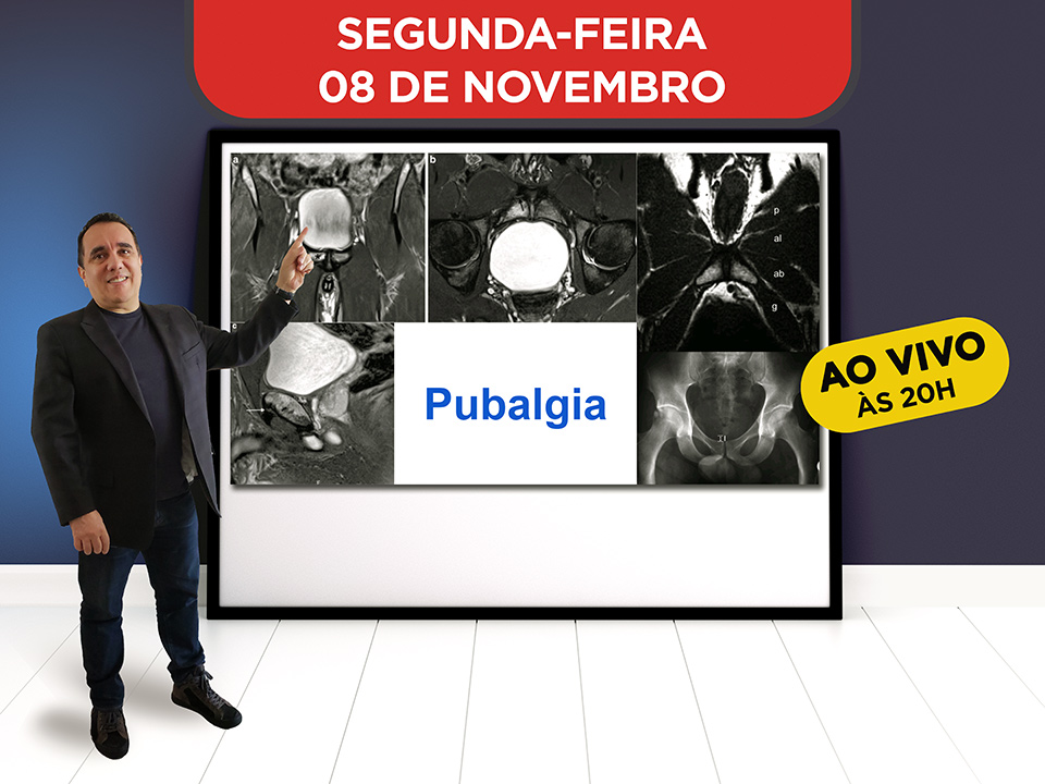 Pubalgia - Hoje ao vivo s 20h, Participe!