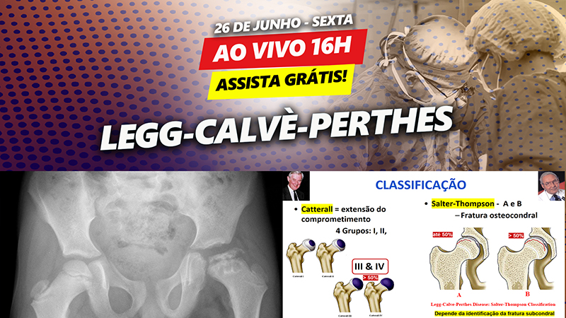 Legg-Calv-Perthes - Assista agora grtis no ondemand!